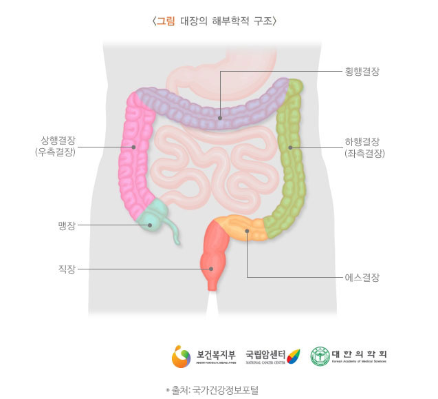 대장암의 원인