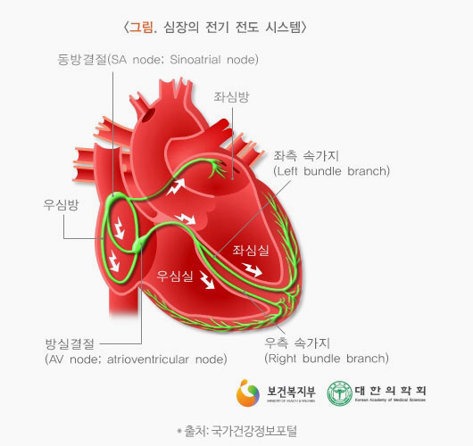 심전도 검사