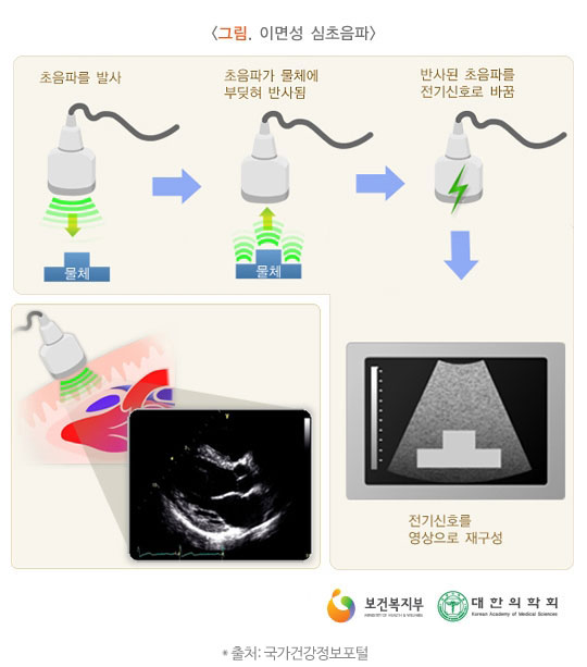 초음파검사