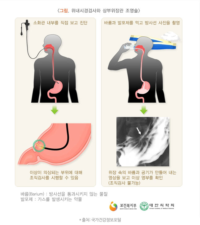 위내시경 검사