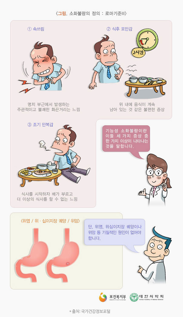 기능성 소화불량